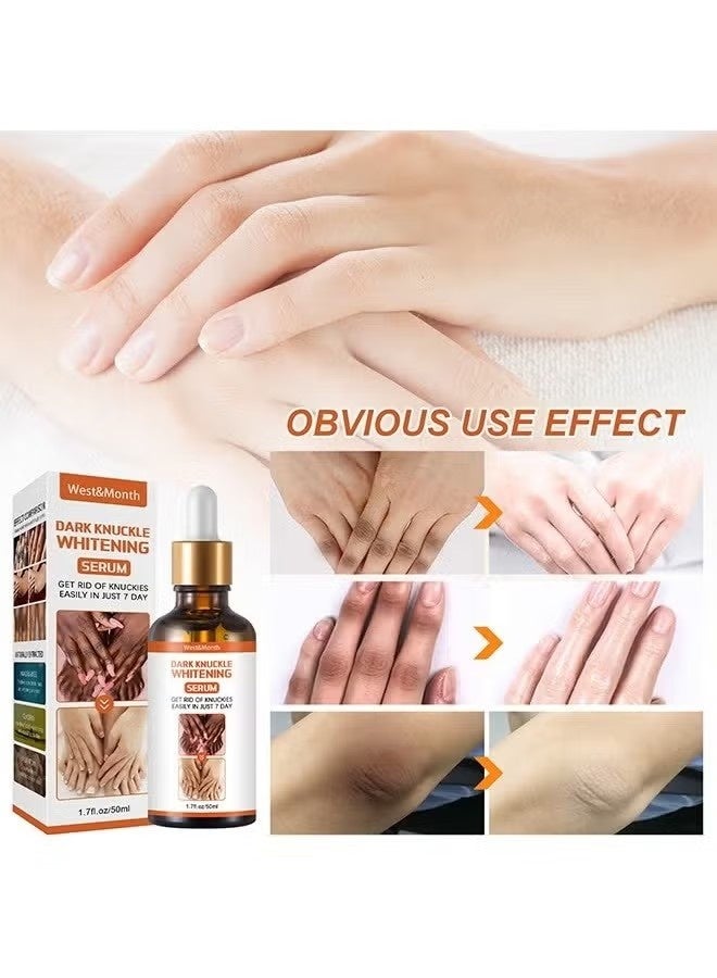 West&Month Dark knuckle Whitening Serum,7 days Treatment for Dark Spots in Hand and Feet Knuckles Exfoliating Improves Dullness Powerful Whitening Effect for Men and Women 50ml - Image 2